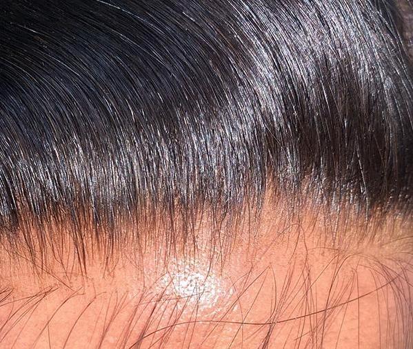 Frontals & Closures